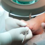 tratamientos para uñas encarnadas, la casa del pie y la uñas, casa medica del pie, casa medica de la uña, clínicas de pie, tratamientos para hongos en uñas, podología en costa rica, podólogos en Costa Rica