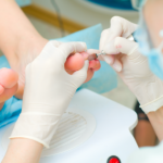 tratamientos para uñas encarnadas, la casa del pie y la uñas, casa medica del pie, casa medica de la uña, clínicas de pie, tratamientos para hongos en uñas, podología en costa rica, podólogos en Costa Rica